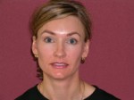 Botulinum Toxin