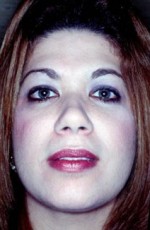 Facial Liposculpture