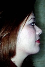 Facial Liposculpture
