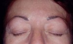 Micropigmentation