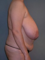 Breast and Abdomen