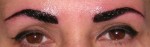 Micropigmentation