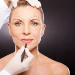Facelift Surgery Financing Options: Pay for Your Surgery Without Stress!