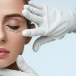 What to Expect During Your Eyelid Surgery Consultation